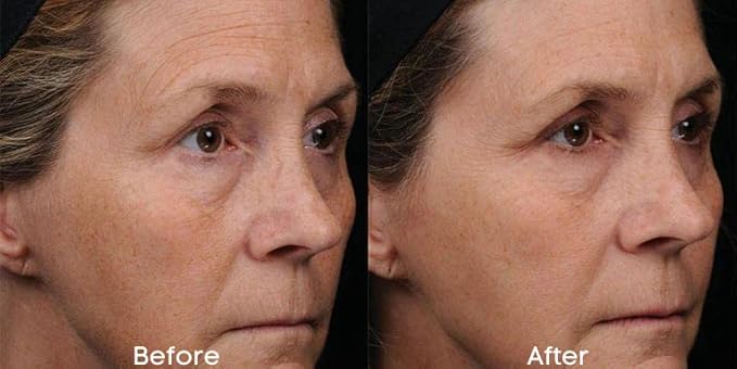 Repair & Replenish All Natural Moisturizing Night Crรจme - Reduce wrinkles, Dark Spots & Fine lines -1.7 OZ