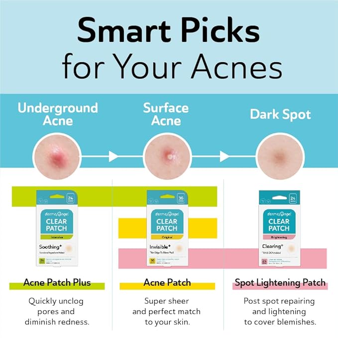 Ultra Invisible Acne Patches for Face Pimple Patches Hydrocolloid Patches Zit Patches Acne Stickers Exposed Skin Care Acne Treatment - Day and Night Use 240 pieces 3 Sizes