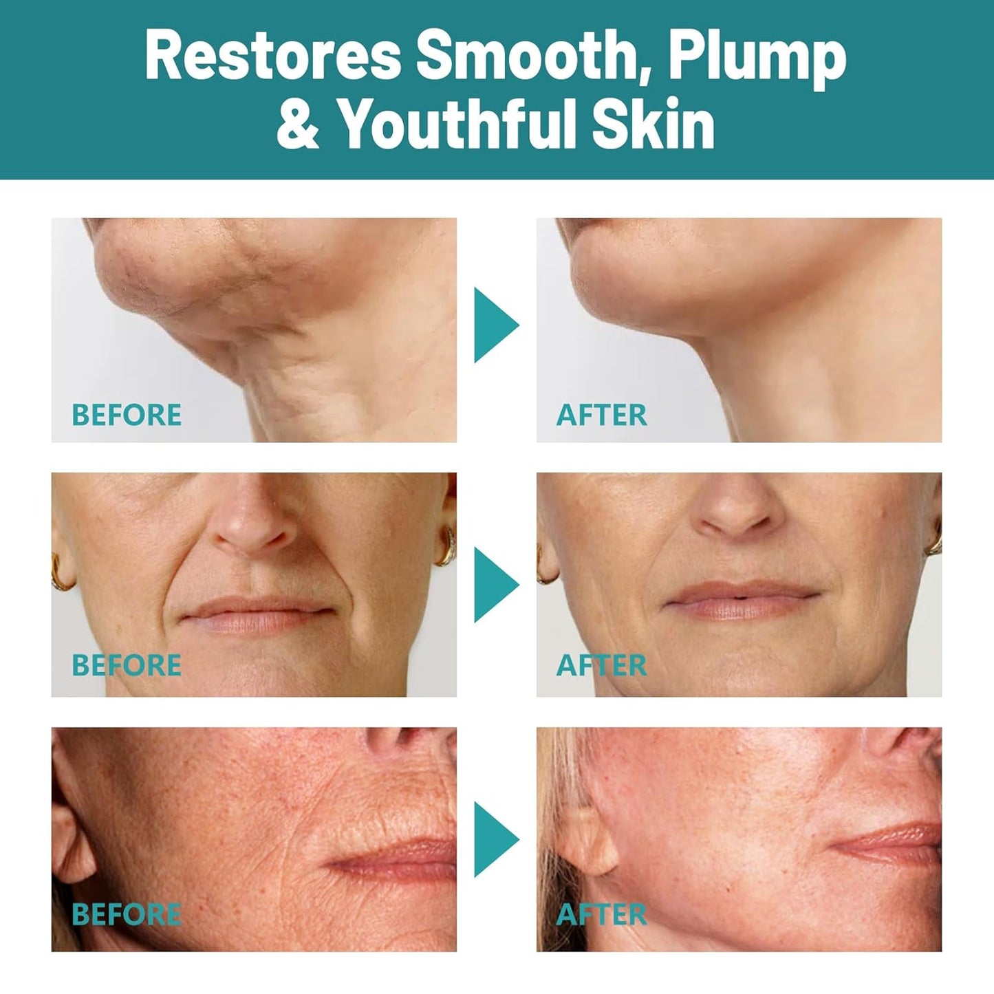 Crepes skin cream for aging skin ,Crepes Skin Repair Treatment, Firming Cream with Hyaluronic Acid & Shea Butter to Deeply Moisturize & Tighten Wrinkly Dry