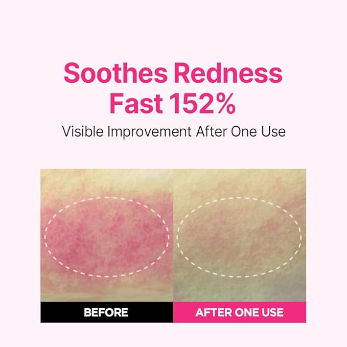 ISOI Rosy Glow Duo - Blemish Care Up Serum & Eye Wrinkle Patch for Glass Skin, Korean Skincare