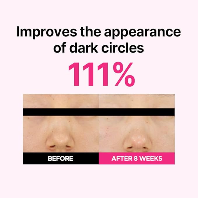 ISOI Rosy Glow Duo - Blemish Care Up Serum & Eye Wrinkle Patch for Glass Skin, Korean Skincare