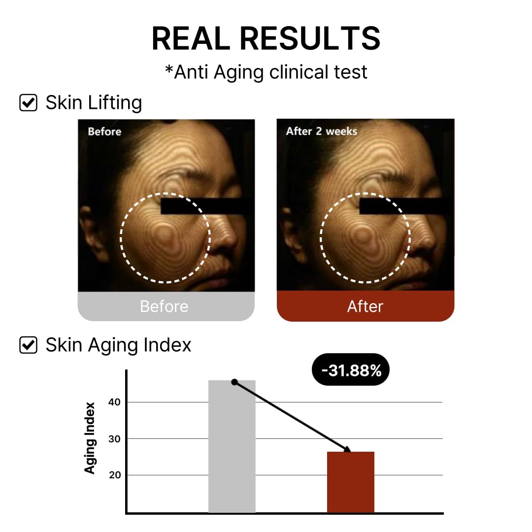 Mito-on Cell Rejuvenation Anti-Aging Serum, 30ml / 1.01 fl.oz –10% Niacinamide, Vitamin B3 and Antioxidants, Centella + EGF for Anti-Aging, Wrinkle Reduction, Pore minimization, Korean Skin Care