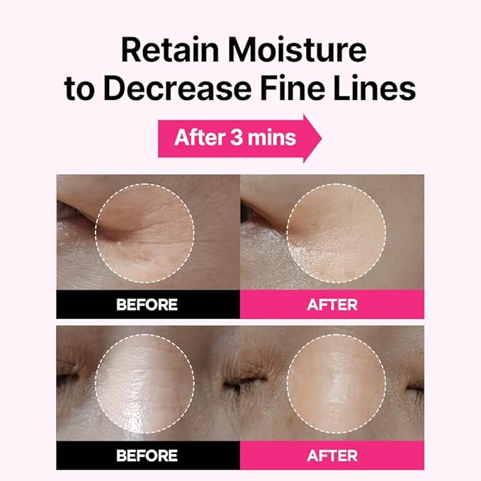 ISOI Rosy Glow Duo - Blemish Care Up Serum & Eye Wrinkle Patch for Glass Skin, Korean Skincare