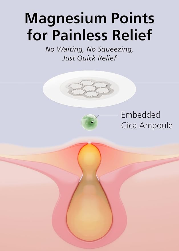 EasyDerm Quick Calming Magnesium Patches – Hydrocolloid Acne Spot Treatment Includes Tweezers & Ampoule, 10 Patches, Zit Sticker, TikTok Viral Blemish Patch, Made by Daewoong Pharmaceutical