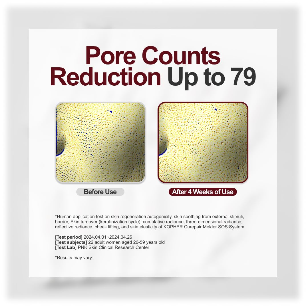 Kopher Curepair Melder SOS System [4ever Edition]