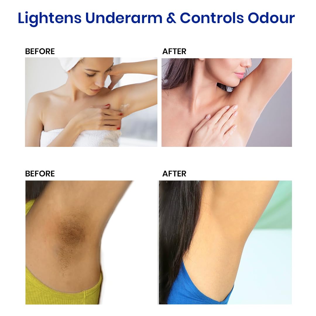 Actitud Underarm Roll On Serum - Roll On Deo for Women & Men with 5% AHA &3% Kojic Acid for Brightening & Odour Control - No Alcohol & Long Lasting Aqua Fresh- 50ml