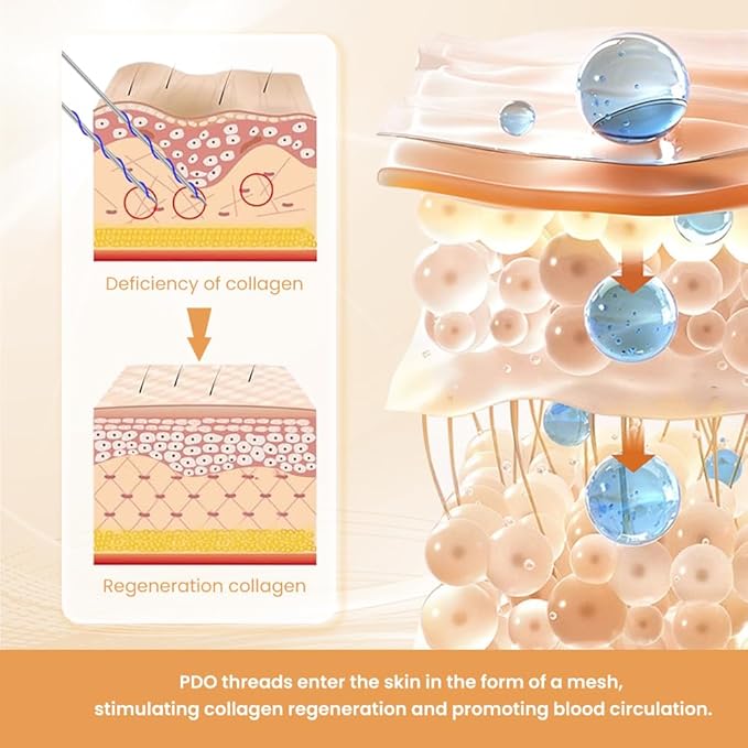 PDO Thread(mono 30G 13MM) For Face Lift /Whole Body Lift Mono Thread/Pdo Mono 30G 13mm Sharp (50pieces)