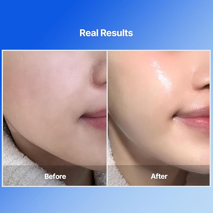 Bluelayer Water Dome Mask & Blue Centella Calming Cream - Blue Hydrogel Overnight Mask and Calming Face Moisturizer for Hydrating - Firming, Moisturizing, and Pore Minimizing for Radiant Glow