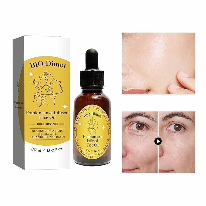 Frankincense Resin Oil, Natural Castor and Jojoba Oils Cold Pressed Serum Face Hydrates Anti-Aging Organic Frankincense Oil. -1Pcs