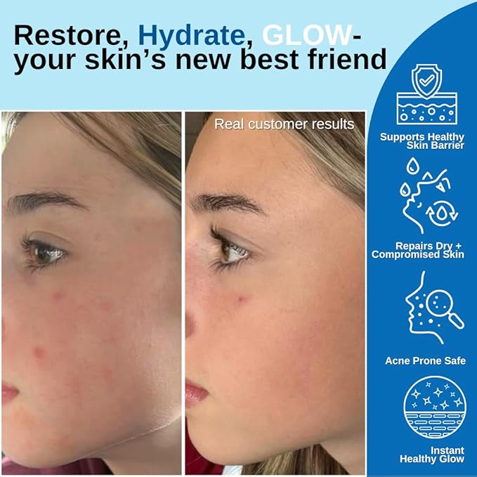 Hydroflora Barrier Repair Oil Gel – Lightweight Moisturizer for Dry, Sensitive Skin – Hydrating Face Oil with CoQ10 & Bakuchiol – Non-Comedogenic, Anti-Aging, Skin Barrier Support