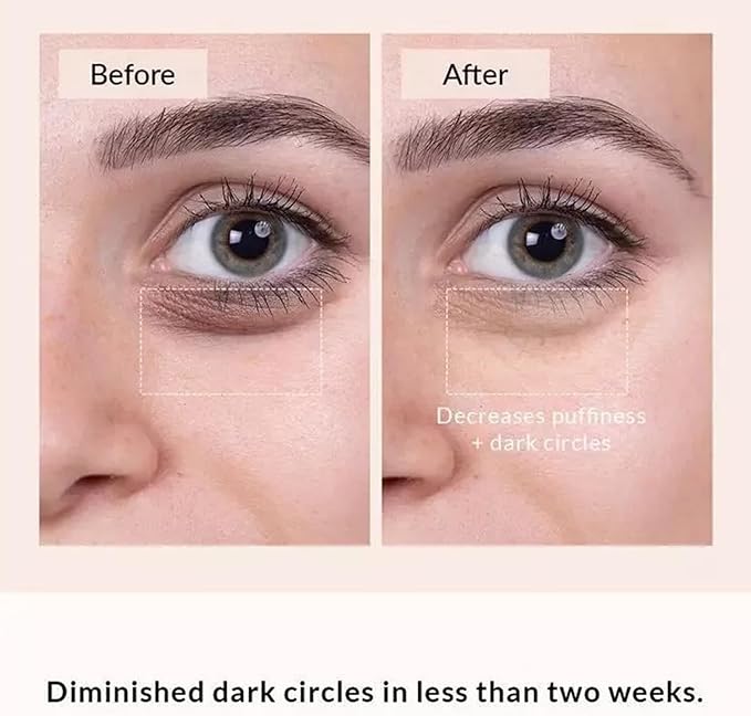 Under Eyes Red Light Therapy, Neodiva Therapy Advanced Under-Eye Renewal Therapy, Microcurrent Eye Beauty Device, Diminishes Dark Circles and Wrinkles
