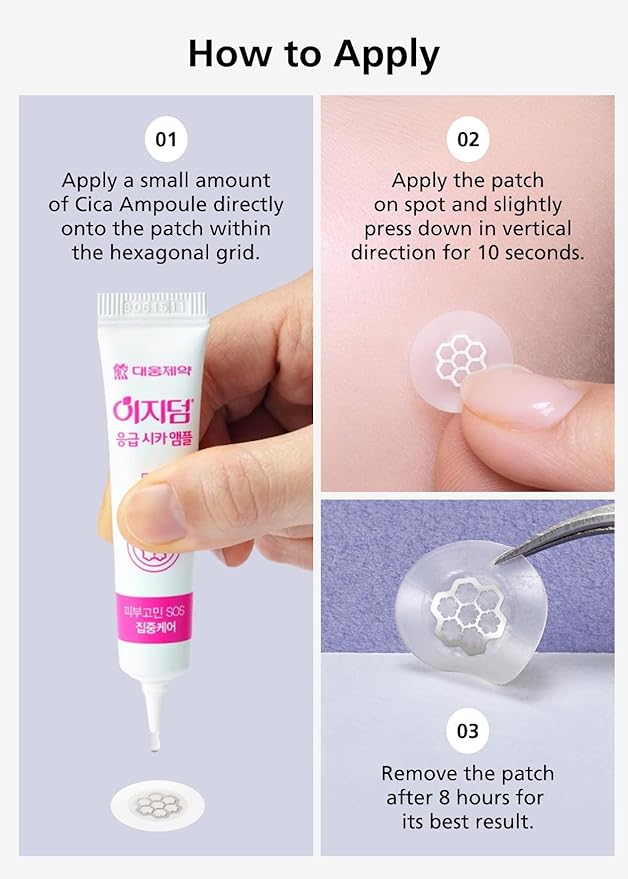 EasyDerm Quick Calming Magnesium Patches – Hydrocolloid Acne Spot Treatment Includes Tweezers & Ampoule, 10 Patches, Zit Sticker, TikTok Viral Blemish Patch, Made by Daewoong Pharmaceutical