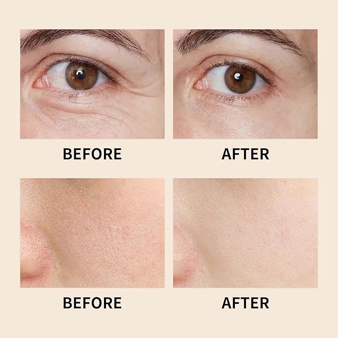 Frankincense Resin Oil, Natural Castor and Jojoba Oils Cold Pressed Serum Face Hydrates Anti-Aging Organic Frankincense Oil. -1Pcs