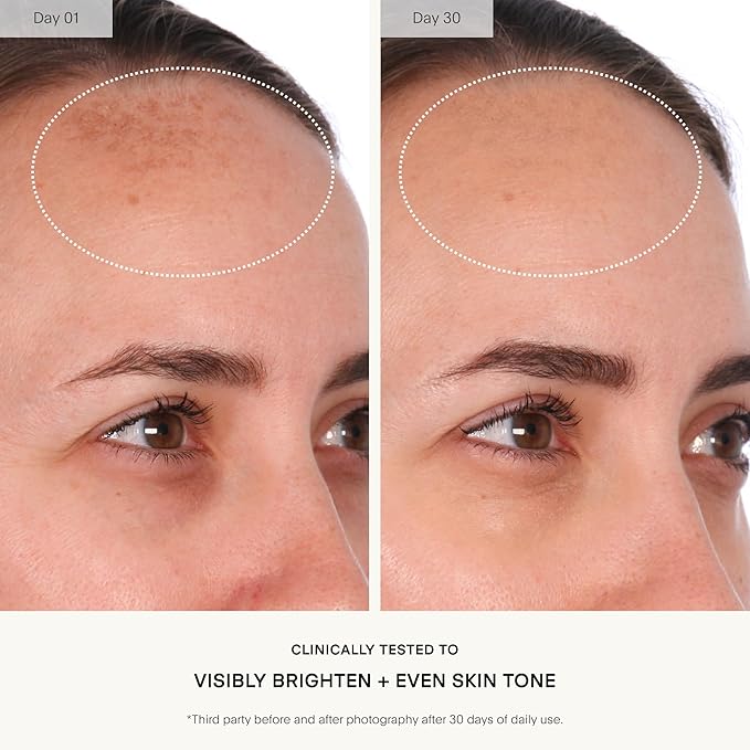 U Beauty Resurfacing Compound Serum - Renew & Illuminate Face Serum - Advanced 8-in-1 Formula with Vitamin C, Retinol, Hyaluronic Acid, & Peptides - Targets Fine Lines, Pores- 1.0 fl.oz