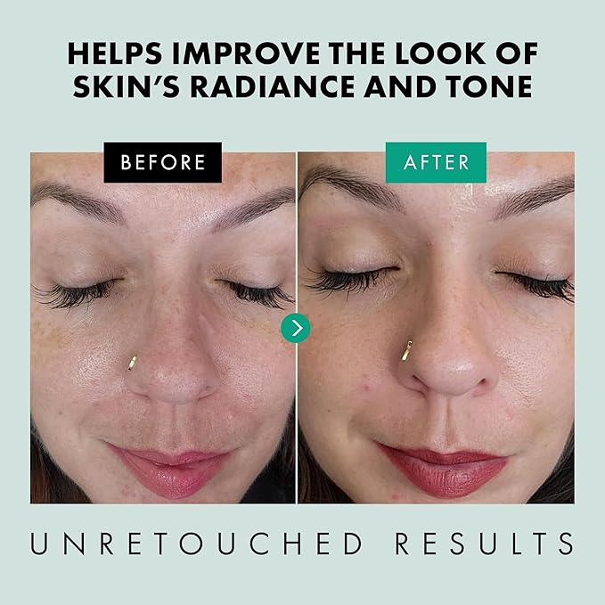 Eclat Skincare Clarifying Niacinamide Serum - 12% Niacinamide with Zinc PCA & Hyaluronic Acid - Hydrating & Soothing Formula - Face Serum for Minimizing Pores and Improving Skin Texture 1 Fl Oz