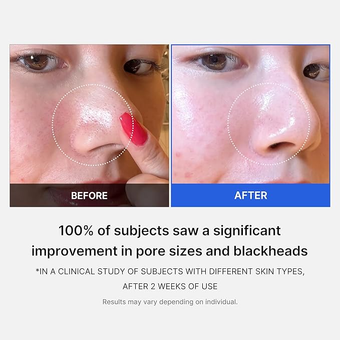 Medicube Zero Pore Pads 2.0, Dual-Textured Facial Toner Pads for Exfoliation and Pore Care with 4.5% AHA Lactic Acid & 0.45% BHA Salicylic Acid, Ideal for All Skin Types, Korean Skin Care (70 Pads)