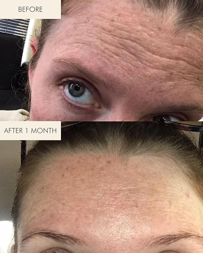 MARA - Natural Evening Primrose + Green Tea Algae Retinol Face Oil | Plant-Based Skin Care | Moisturizes + Soothes Skin To Minimizes Look of Pores + Fine Lines (Full Size, 1 fl oz | 30 ml)