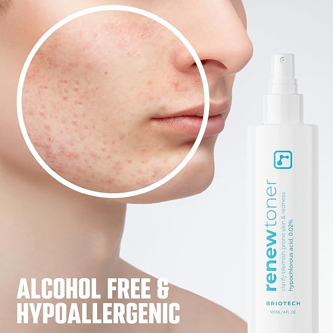 BRIOTECH Skin Renew Toner, Hypochlorous Acid Spray Topical Skin Spray for Face and Skin, Minimize Appearance of Blemishes, Soothing Mist for Redness & Bumps, 4 fl oz
