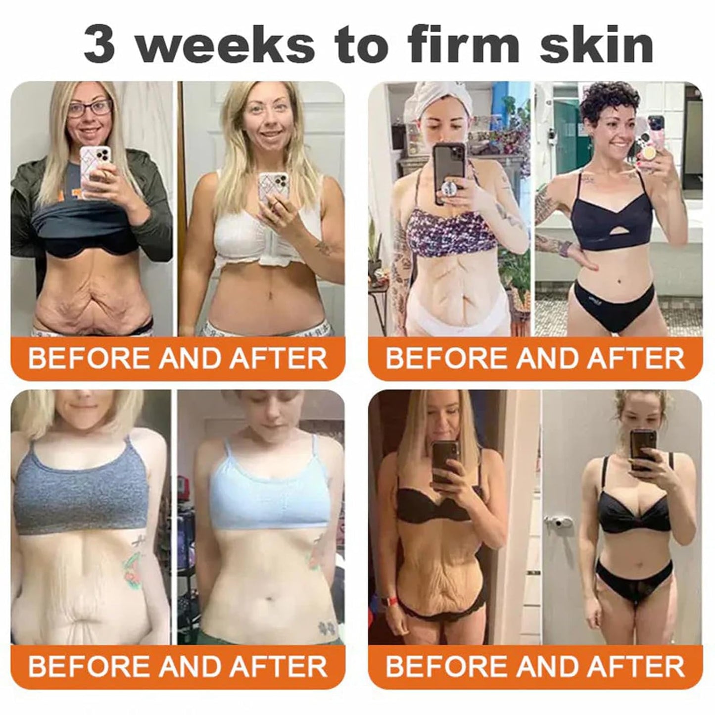 Bee Venom Comprehensive Cream, Professional bee venom cream for Removing and Repair, APKAPK Bee Venom Skin Treatment Cream, Natural Serum Suitable for All Skin Types (2 Pack)