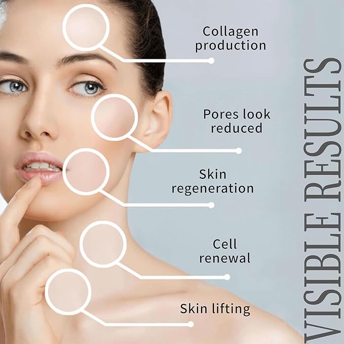 Pdo Threads Pdo Threads Lift for Face Smoothing Wrinkles Pdo Screw Threads Producs Collagen Pdo Lifting Threads Skin Tighten 27g50mm 40Pcs