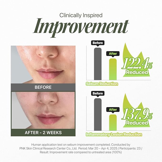 Trouble Patch Mask | Full-Face Hydrocolloid Acne Mask with Skin-Balancing Reset Care & Tea Tree Biome for Acne-Prone Skin | Korean Face Mask (20ml x 4)