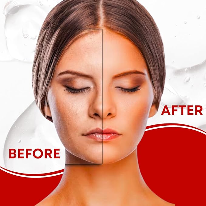 Generic Retinol Pro Night Cream 0.05 Vitamin A Fine Lines, Sun Spots, Anti-Aging (30 Gram / 1.05 Oz)