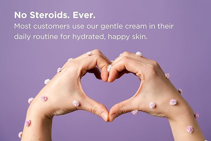 Seborrheic Dermatitis Face Cream for Sensitive Skin - Hydrates & Supports the Skin Barrier with MCT Oil, Squalane - Moisturizing Face, Scalp and Body Cream - No Steroids, Gentle Ingredients