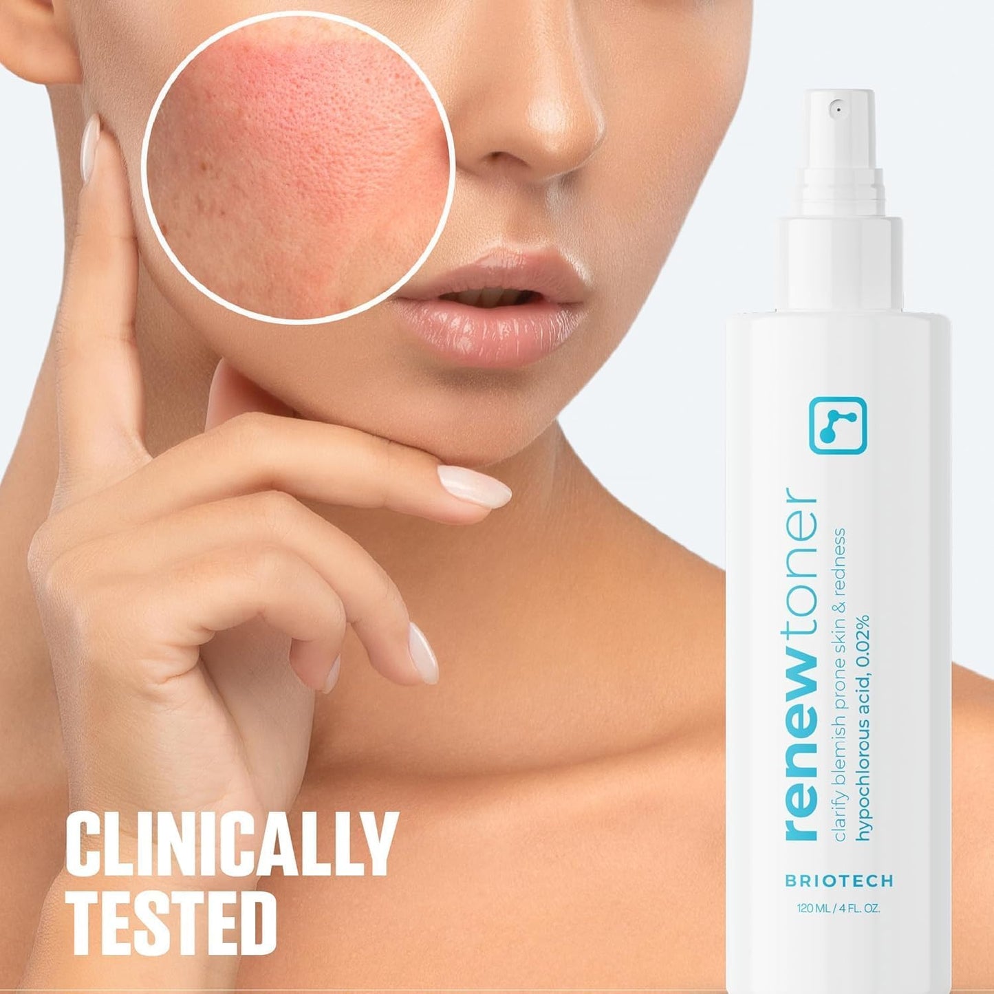 BRIOTECH Renew Toner, Hypochlorous Acid Spray, Minimize Appearance of Blemishes, Soothing Facial Mist for Sensitive Skin, Calm Redness & Bumps, Vegan, 2 fl oz Travel Size