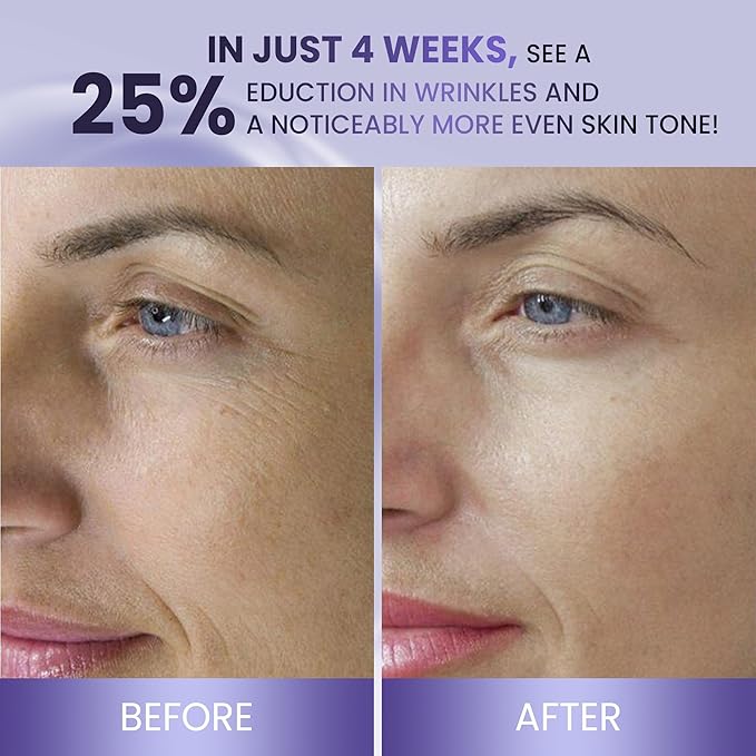 ABERA BELANI Retinol Night Cream For Women, Dark Spot Remover, Melasma Treatment, Reduce Fine Lines, Anti-Wrinkle, Anti-Aging Neck and Décolleté For Face (3 Box + Gift Eyelash Serum)