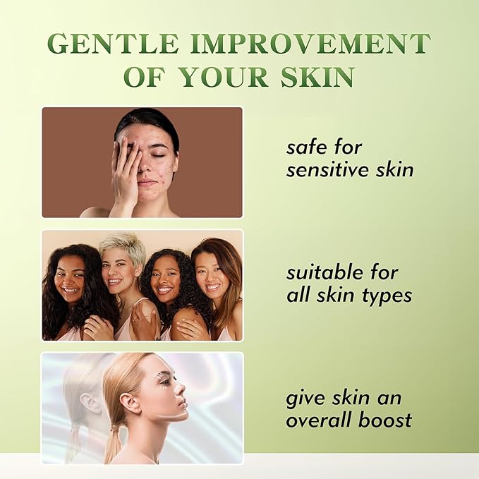 elves Pdo Threads Multi for Face and Whole Body Lift/Multi Threads Pdo with Blunt L Tip/Comes With The Pilot/Starter Tip/ 20pieces (21G50mm)