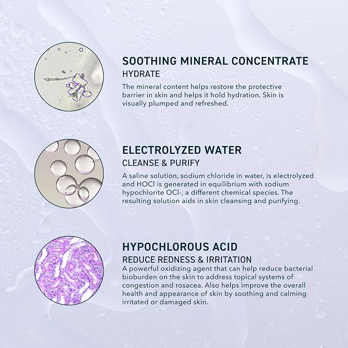 Prequel Skin Universal Skin Solution Hypochlorous Acid Spray for Face and Body. Fine Mist HOCL Facial Cleanser and Dermal Spray with Minerals & Electrolyzed Water - pH-Stabilized Care. 4oz