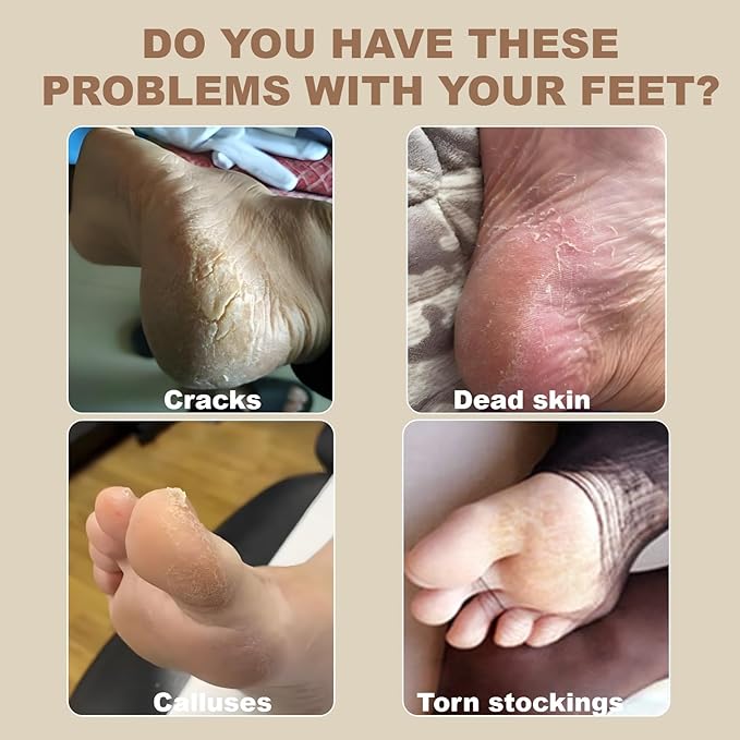Callus Remover for Feet, Pedicure Tools for Feet with 3 Grinding Heads, Waterproof Foot Callus Remover for Dead Cracked Dry Skin Calluses