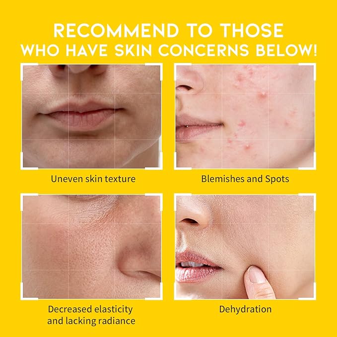 Boosting Toner Pads for Face Oily Skin Korean, #OOTD Vitamin C Niacinamide Heartleaf Hydrating Calming Redness, Vitamin C Toner Pad 70Pads 4.05oz 120ml