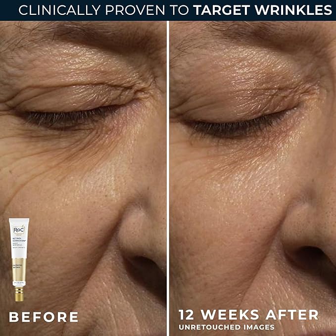 RoC Retinol Correxion Value Set Duo, Deep Wrinkle Anti-Aging Night Face Cream + Daily Under Eye Cream for Dark Circles & Puffiness , Skin Care Set (Packaging May Vary)