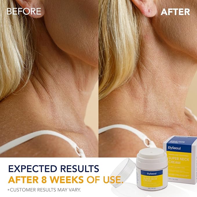 Korean Neck Cream for Firming & Tightening: Neck & Chest Anti-Aging Treatment for Crepey Sagging Skin & Wrinkles - Women & Men Turkey Neck Perfecting, 1.7 oz