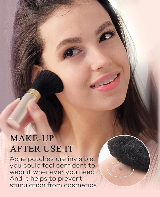 Acne Patches Pimple Patches for Face 4 Sizes 528 Count