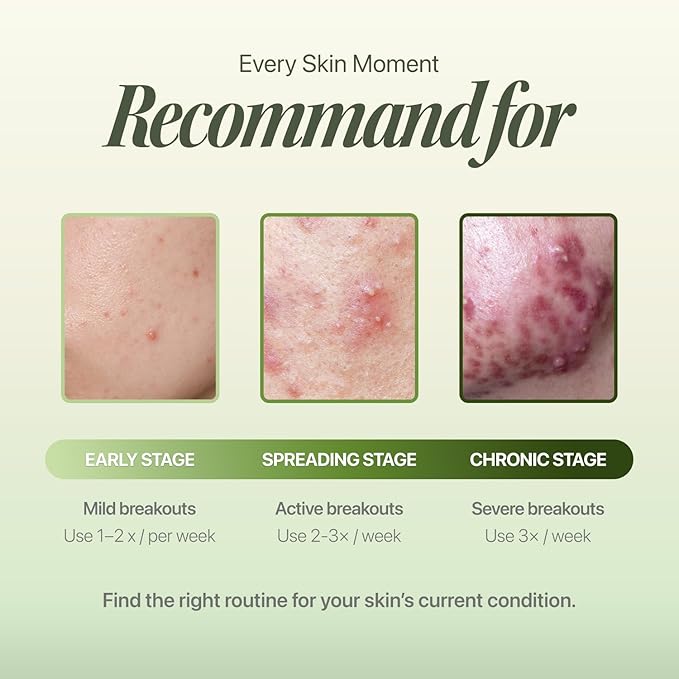 Trouble Patch Mask | Full-Face Hydrocolloid Acne Mask with Skin-Balancing Reset Care & Tea Tree Biome for Acne-Prone Skin | Korean Face Mask (20ml x 4)