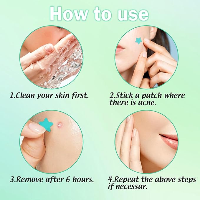 Star Pimple Patches For Face 240 Counts Hydrocolloid Acne Patches with Tea Tree Oil Blemish Zit Patches For Face 3 Sizes Acne Patch Acne Dots Patches 6 colors Pink Yellow Blue Star Pimple Patches