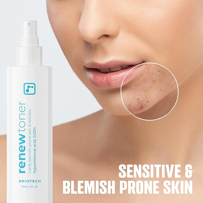 BRIOTECH Skin Renew Toner, Hypochlorous Acid Spray Topical Skin Spray for Face and Skin, Minimize Appearance of Blemishes, Soothing Mist for Redness & Bumps, 4 fl oz ea, 4 ct