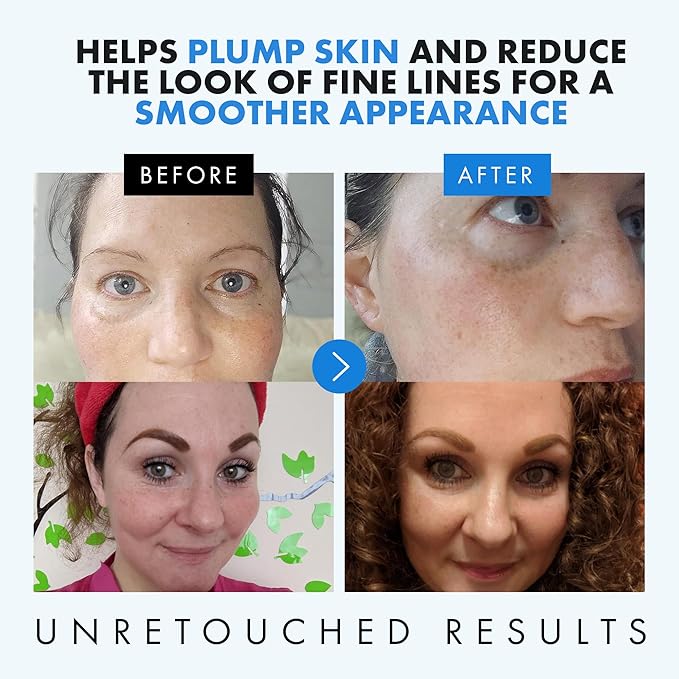 Eclat Skincare Hydrating Hyaluronic Acid Serum for Face – 2.5% Hyaluronic Acid + 3% B5, Green Tea & Jojoba Oil - Moisturizing & Plumping Formula for Radiant & Smoother Skin 1 Fl Oz