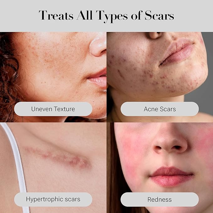 Sucral Overnight Solution Cream (1.01oz) - Advanced Dark Spot Corrector Cream for Face, Infused with Calming Ingredients, Ideal for All Skin Types