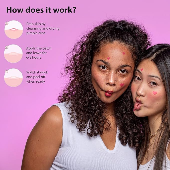 Frilliance Pink Heart Shaped Hydrocolloid Acne Pimple Patches for Zits and Blemishes (36 Count, 2 Sizes) Spot Treatment Stickers for Face & Skin, Vegan and Cruelty Free