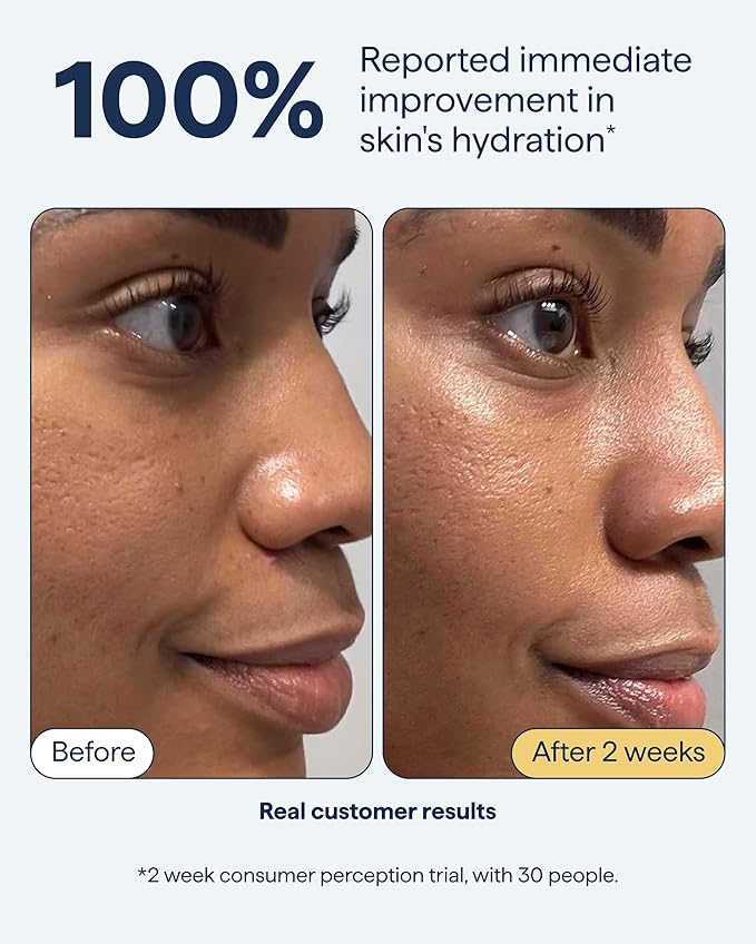 Remedy Rich Cream Barrier Repairing Facial Moisturizer - Remedy for Rich Moisture - For Normal to Dry Skin - Quadruple Ceramides, Peptides, Squalane, Glycerin- By Dermatologist Dr. Shah, 1.7 fl. oz