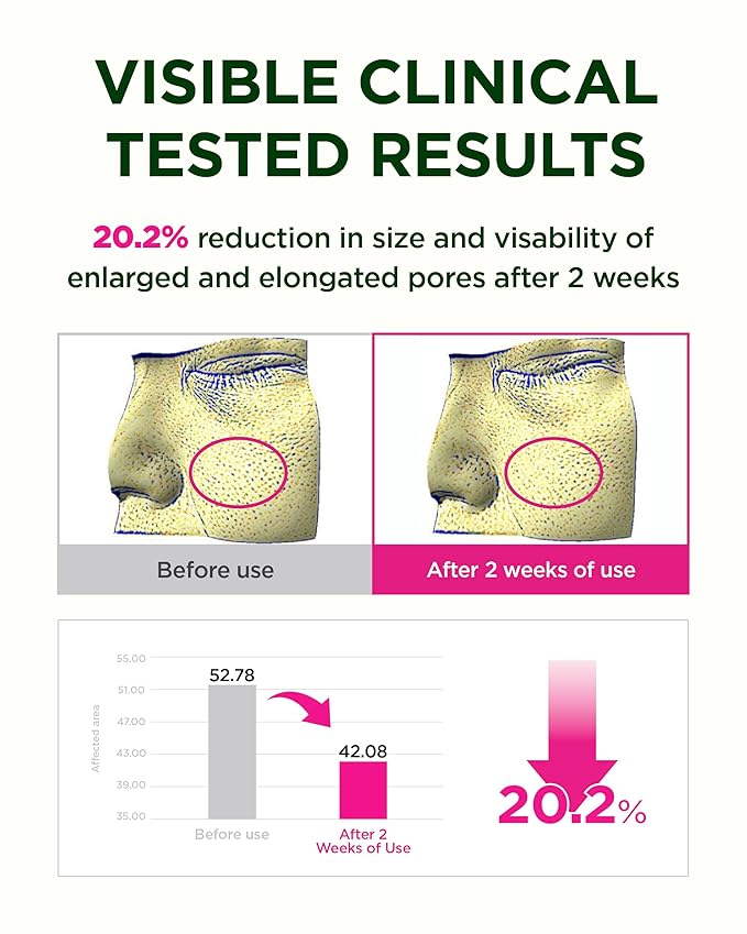 CKD Retino Collagen Boosting Hydrogel Face Mask (5ea) - Korean Overnight Jelly Mask for Glass Skin, Deep Moisturizing, and Pore Minimizing with Retinal & Low Molecular Collagen. Korean Skin Care