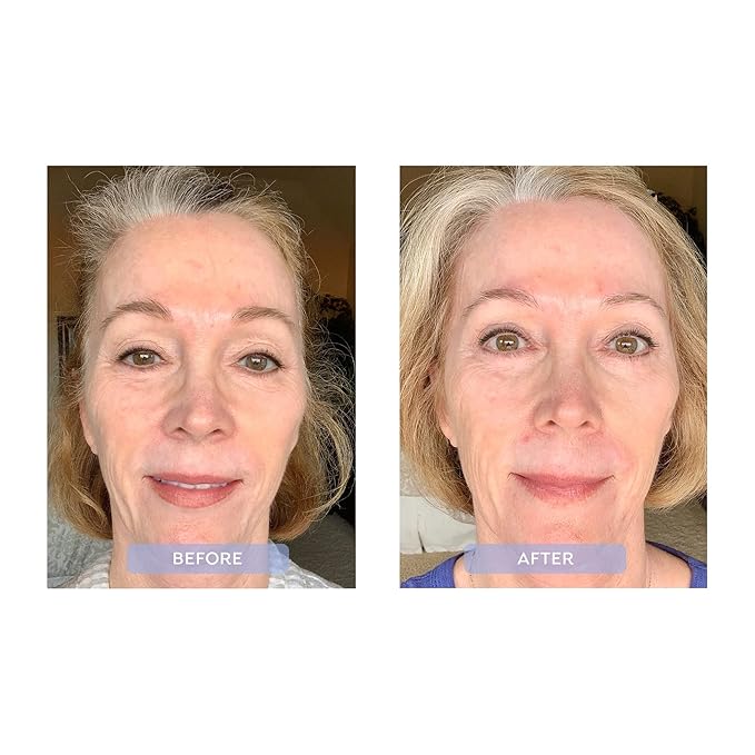 Dr. Zenovia Hormonal Dermatology Inflam-Aging Night Repair Treatment - Skin Firming And Tightening Lotion